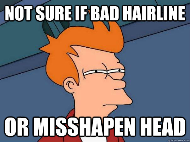 Not sure if bad hairline or misshapen head - Not sure if bad hairline or misshapen head  Futurama Fry