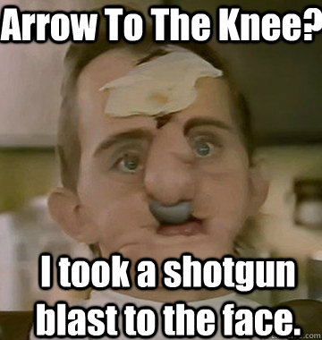 Arrow To The Knee? I took a shotgun blast to the face. - Arrow To The Knee? I took a shotgun blast to the face.  Real Adventurer