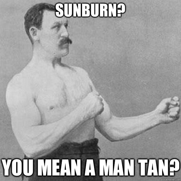 Sunburn? YOU MEAN A MAN TAN? - Sunburn? YOU MEAN A MAN TAN?  overly manly man