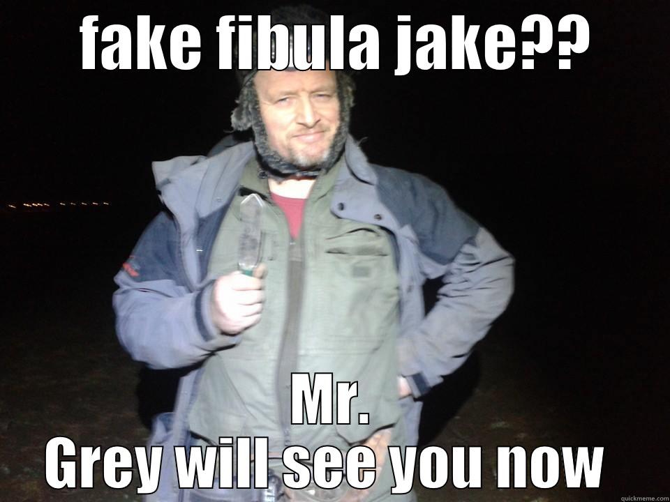  fake fibula ?? -  FAKE FIBULA JAKE?? MR. GREY WILL SEE YOU NOW  Misc