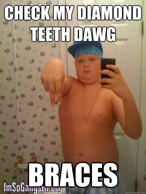 check my diamond teeth dawg braces  Wannabe Gangster Kid