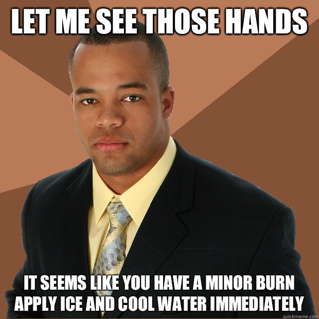 Let me see those hands It seems like you have a minor burn apply ice and cool water immediately - Let me see those hands It seems like you have a minor burn apply ice and cool water immediately  Successful Black Man