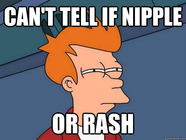 can't tell if nipple or rash  Futurama Fry