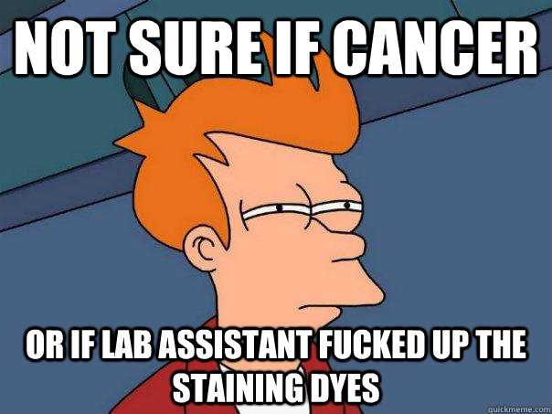 Not sure if cancer  Or if lab assistant fucked up the staining dyes  Futurama Fry