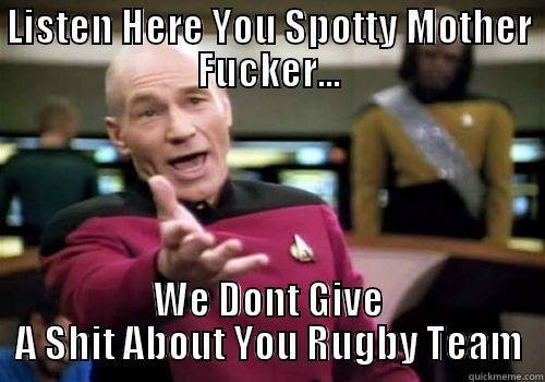 LISTEN HERE YOU SPOTTY MOTHER FUCKER... WE DONT GIVE A SHIT ABOUT YOU RUGBY TEAM Misc