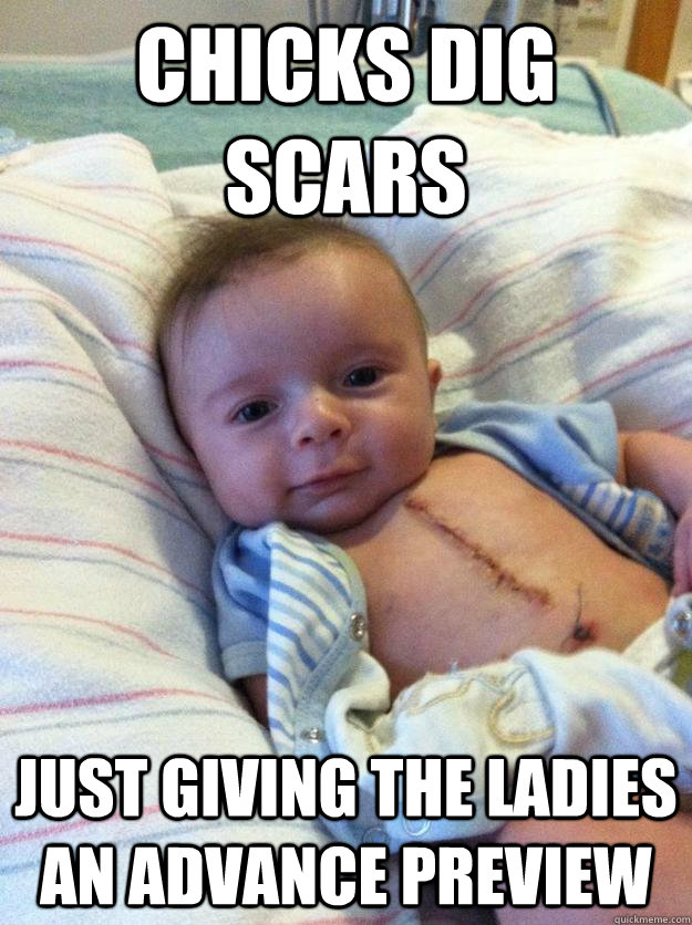 chicks dig scars just giving the ladies an advance preview  Ridiculously Goodlooking Surgery Baby