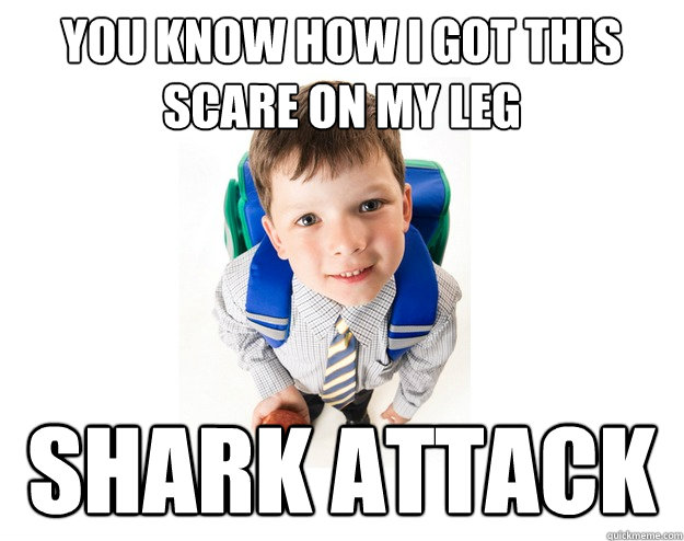 you know how i got this scare on my leg shark attack   Lying School Kid