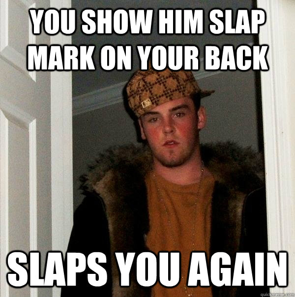 You show him slap mark on your back Slaps you again  Scumbag Steve