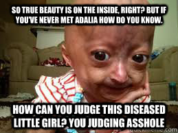 So true beauty is on the inside, right? But if you've never met Adalia how do you know. How can you judge this diseased little girl? You judging asshole - So true beauty is on the inside, right? But if you've never met Adalia how do you know. How can you judge this diseased little girl? You judging asshole  judging