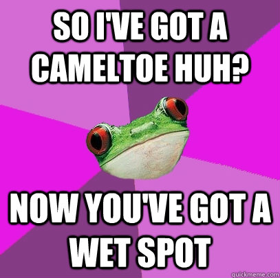 So I've Got A Cameltoe huh? Now you've got a wet spot  Foul Bachelorette Frog