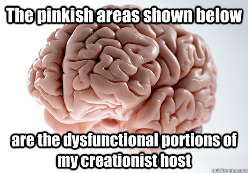 The pinkish areas shown below  are the dysfunctional portions of my creationist host   Scumbag Brain