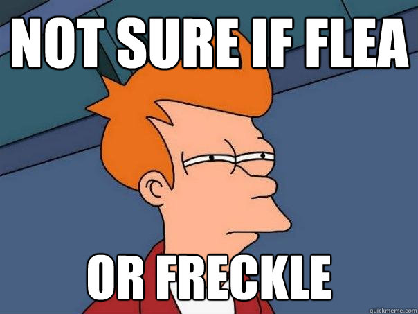 Not sure if flea or freckle - Not sure if flea or freckle  Futurama Fry