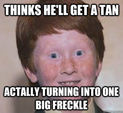 Thinks He'll get a tan Actally turning into one big Freckle - Thinks He'll get a tan Actally turning into one big Freckle  Over Confident Ginger