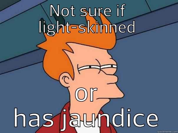 NOT SURE IF LIGHT-SKINNED OR HAS JAUNDICE Futurama Fry