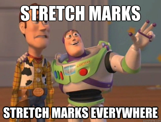 Stretch Marks Stretch marks everywhere  Buzz Lightyear