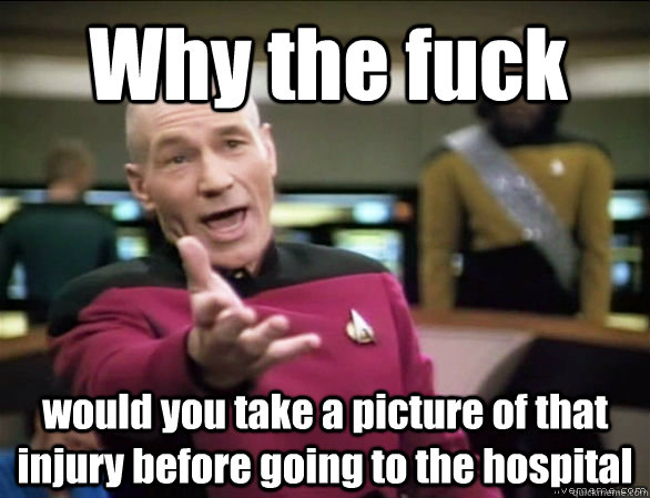 Why the fuck would you take a picture of that injury before going to the hospital - Why the fuck would you take a picture of that injury before going to the hospital  Annoyed Picard HD