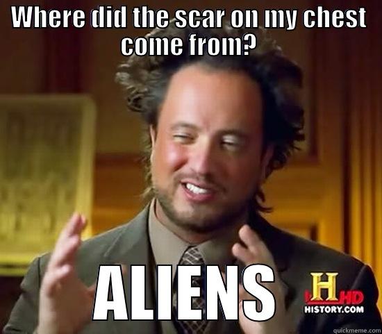 Open Heart Surgery - WHERE DID THE SCAR ON MY CHEST COME FROM? ALIENS Ancient Aliens