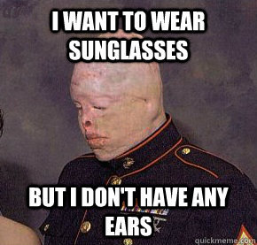 i want to wear sunglasses but i don't have any ears  Burn Victim Bobby