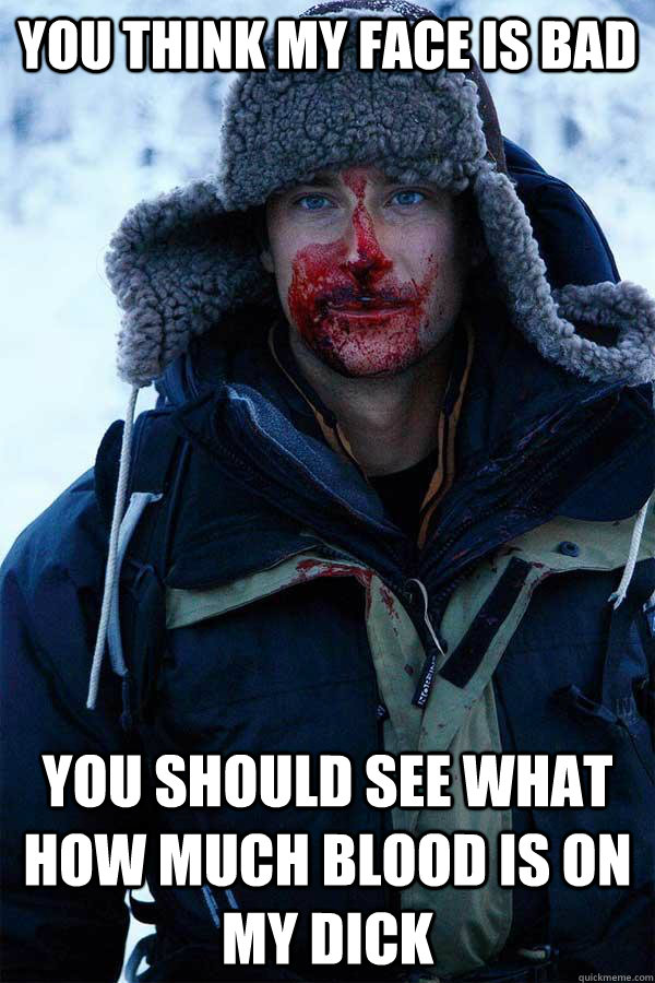 you think my face is bad you should see what how much blood is on my dick  Bear Grylls