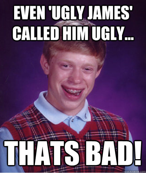 even 'ugly james' called him ugly... thats bad!   Bad Luck Brian