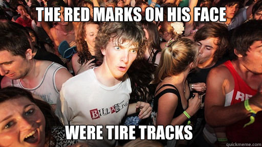 The red marks on his face were tire tracks  Sudden Clarity Clarence