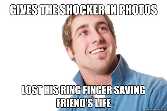 gives the shocker in photos lost his ring finger saving friend's life  Misunderstood D-Bag