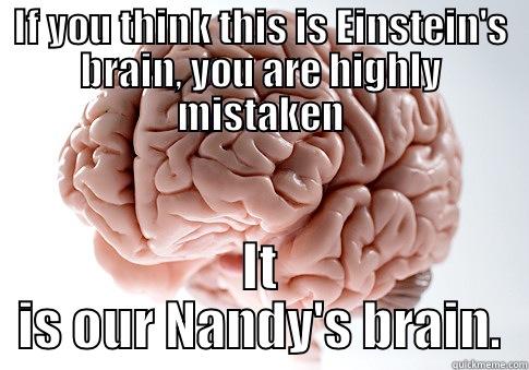 IF YOU THINK THIS IS EINSTEIN'S BRAIN, YOU ARE HIGHLY MISTAKEN IT IS OUR NANDY'S BRAIN. Scumbag Brain