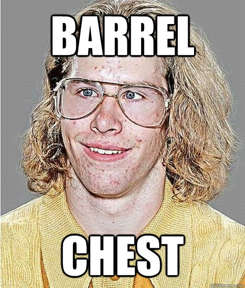 Barrel chest  NeoGAF Asshole