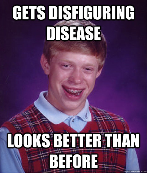 Gets disfiguring disease looks better than before  Bad Luck Brian