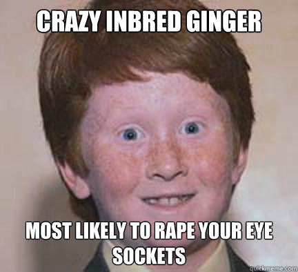 Crazy inbred ginger Most likely to rape your eye sockets  Over Confident Ginger