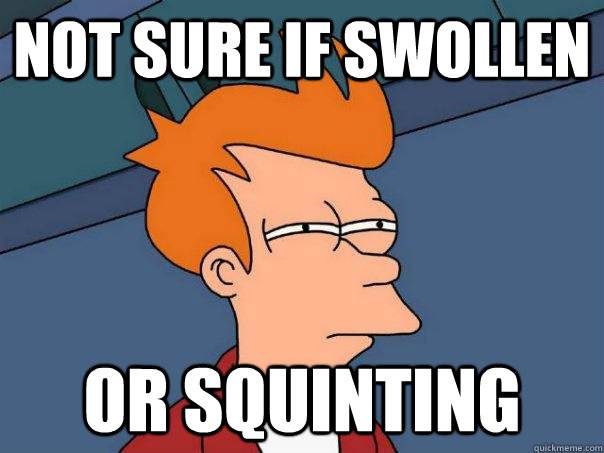 Not sure if swollen Or squinting - Not sure if swollen Or squinting  Futurama Fry