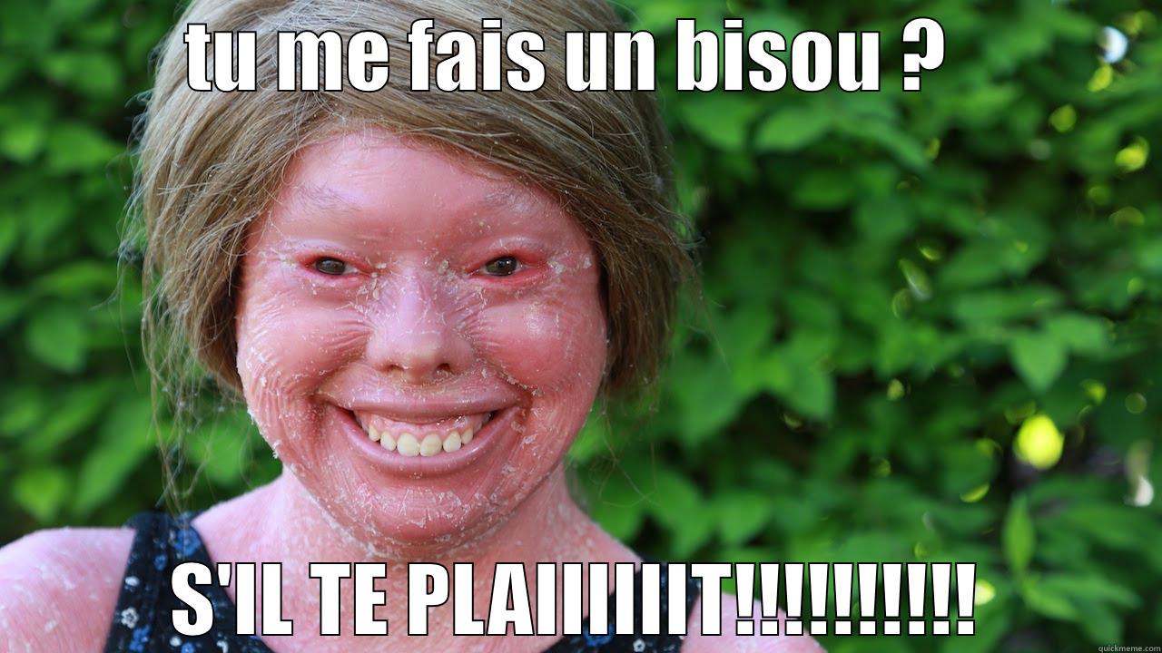 TU ME FAIS UN BISOU ?  S'IL TE PLAIIIIIIT!!!!!!!!!! Misc