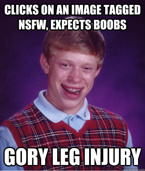 clicks on an image tagged nsfw, expects boobs gory leg injury  Bad Luck Brian