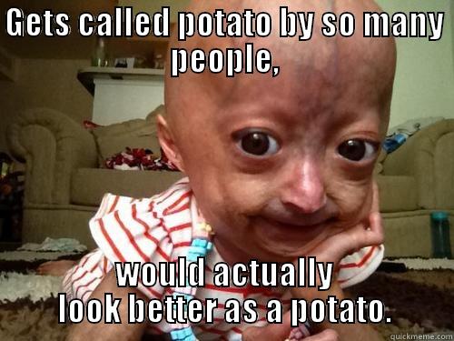 GETS CALLED POTATO BY SO MANY PEOPLE, WOULD ACTUALLY LOOK BETTER AS A POTATO. Misc