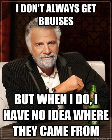 I don't always get bruises but when i do, i have no idea where they came from - I don't always get bruises but when i do, i have no idea where they came from  The Most Interesting Man In The World