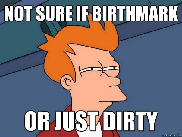 NOT SURE IF birthmark OR JUST dirty  Futurama Fry