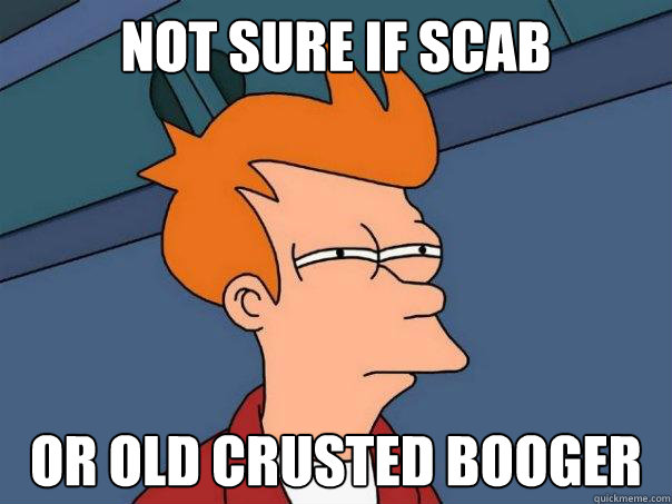 Not sure if Scab Or old crusted booger  Futurama Fry