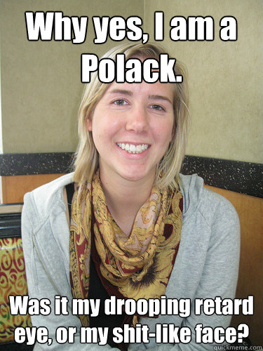 Why yes, I am a Polack. Was it my drooping retard eye, or my shit-like face?  ALYSSA BEREZNAK