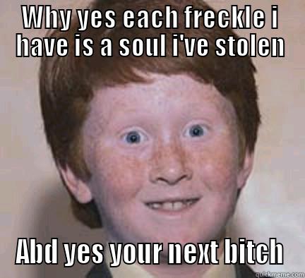 WHY YES EACH FRECKLE I HAVE IS A SOUL I'VE STOLEN ABD YES YOUR NEXT BITCH Over Confident Ginger