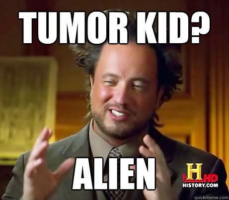 Tumor Kid? ALIEN  History Channel Guy