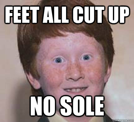 FEET ALL CUT UP NO SOLE  Over Confident Ginger