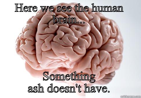 HERE WE SEE THE HUMAN BRAIN... SOMETHING ASH DOESN'T HAVE. Scumbag Brain