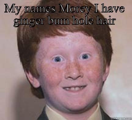 MY NAMES MOREY I HAVE GINGER BUM HOLE HAIR  Over Confident Ginger