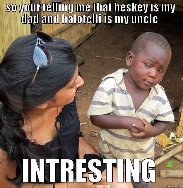 SO YOUR TELLING ME THAT HESKEY IS MY DAD AND BALOTELLI IS MY UNCLE  INTRESTING Skeptical Third World Kid