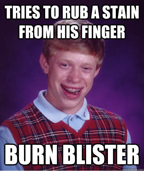 TRIES TO RUB A STain from his finger burn blister - TRIES TO RUB A STain from his finger burn blister  Bad Luck Brian