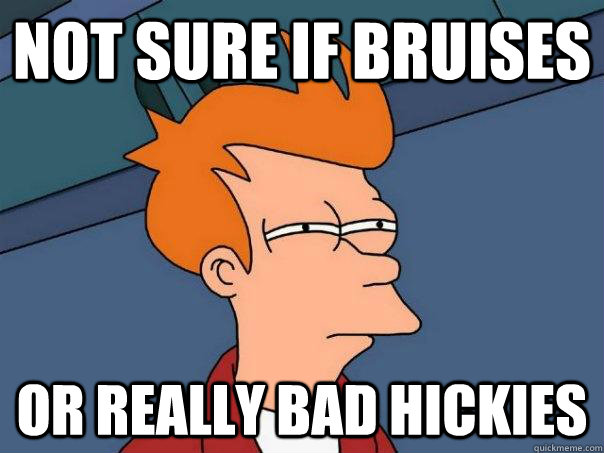 Not sure if bruises or really bad hickies - Not sure if bruises or really bad hickies  Futurama Fry