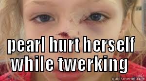  PEARL HURT HERSELF WHILE TWERKING  Misc