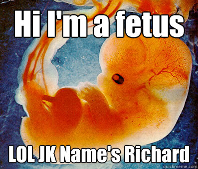 Hi I'm a fetus LOL JK Name's Richard - Hi I'm a fetus LOL JK Name's Richard  Fetusrich