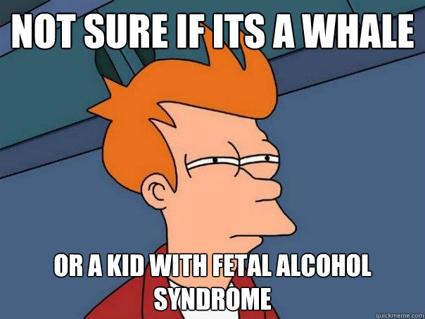 Not sure if its a whale Or a kid with fetal alcohol syndrome - Not sure if its a whale Or a kid with fetal alcohol syndrome  Futurama Fry