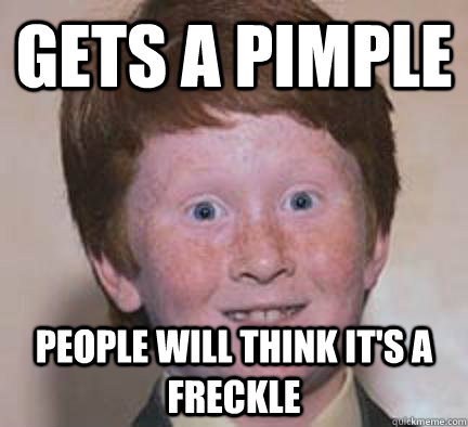 Gets a pimple People will think it's a freckle  Over Confident Ginger